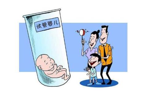 时差培养箱